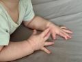 Спасли годовалого ребёнка, выпившего уксусную эссенцию, врачи Детской больницы ЕАО